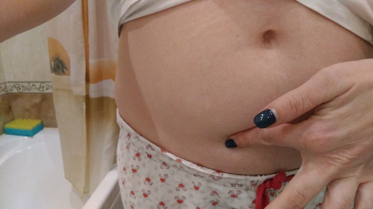 Anzeichen einer Helmintheninfektion aus eigener Erfahrung.