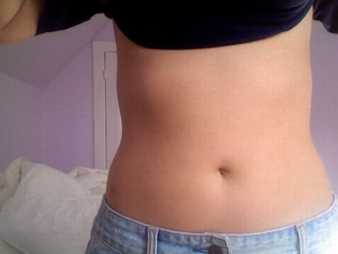 Das Ergebnis der Behandlung mit NEOflorax-Kapseln.