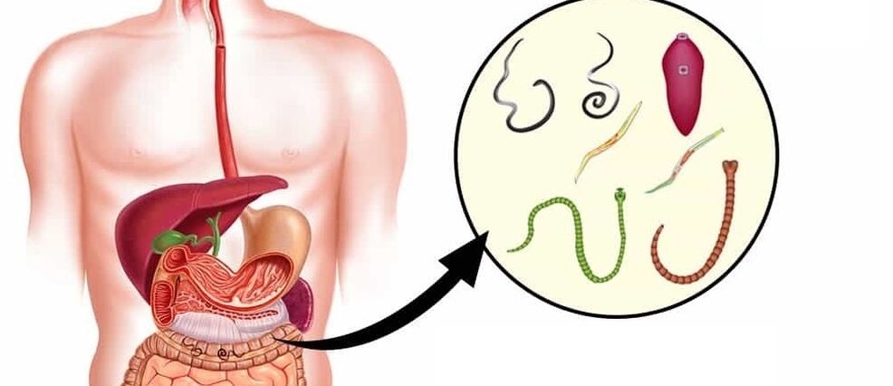 Parasiten im menschlichen Körper.